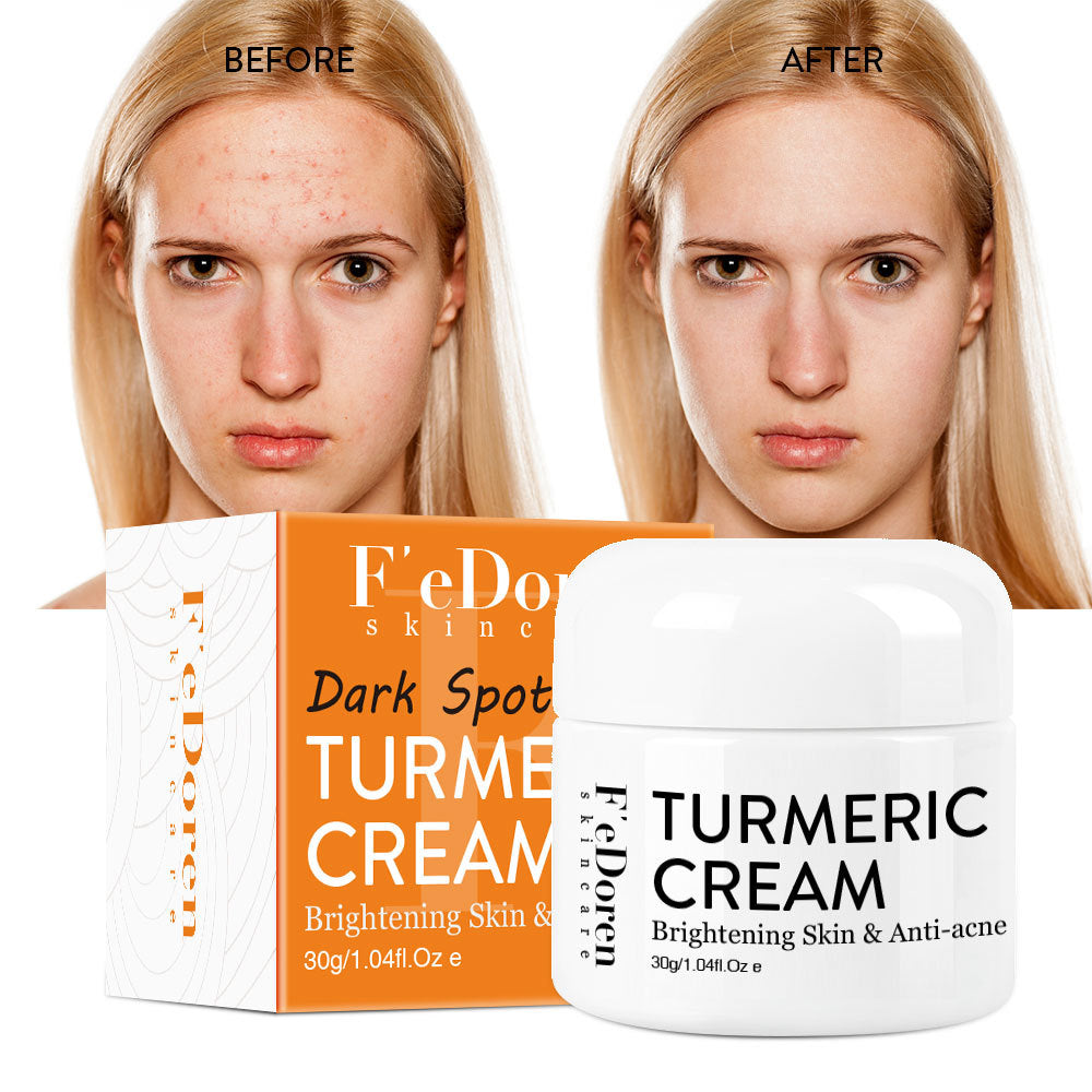 Turmeric Cream To Brighten Skin Tone